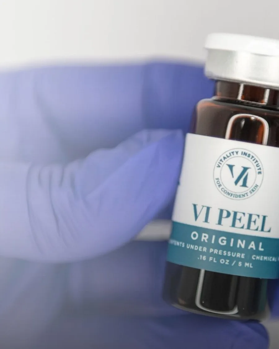 VI Peel at Back to 30 Med Spa