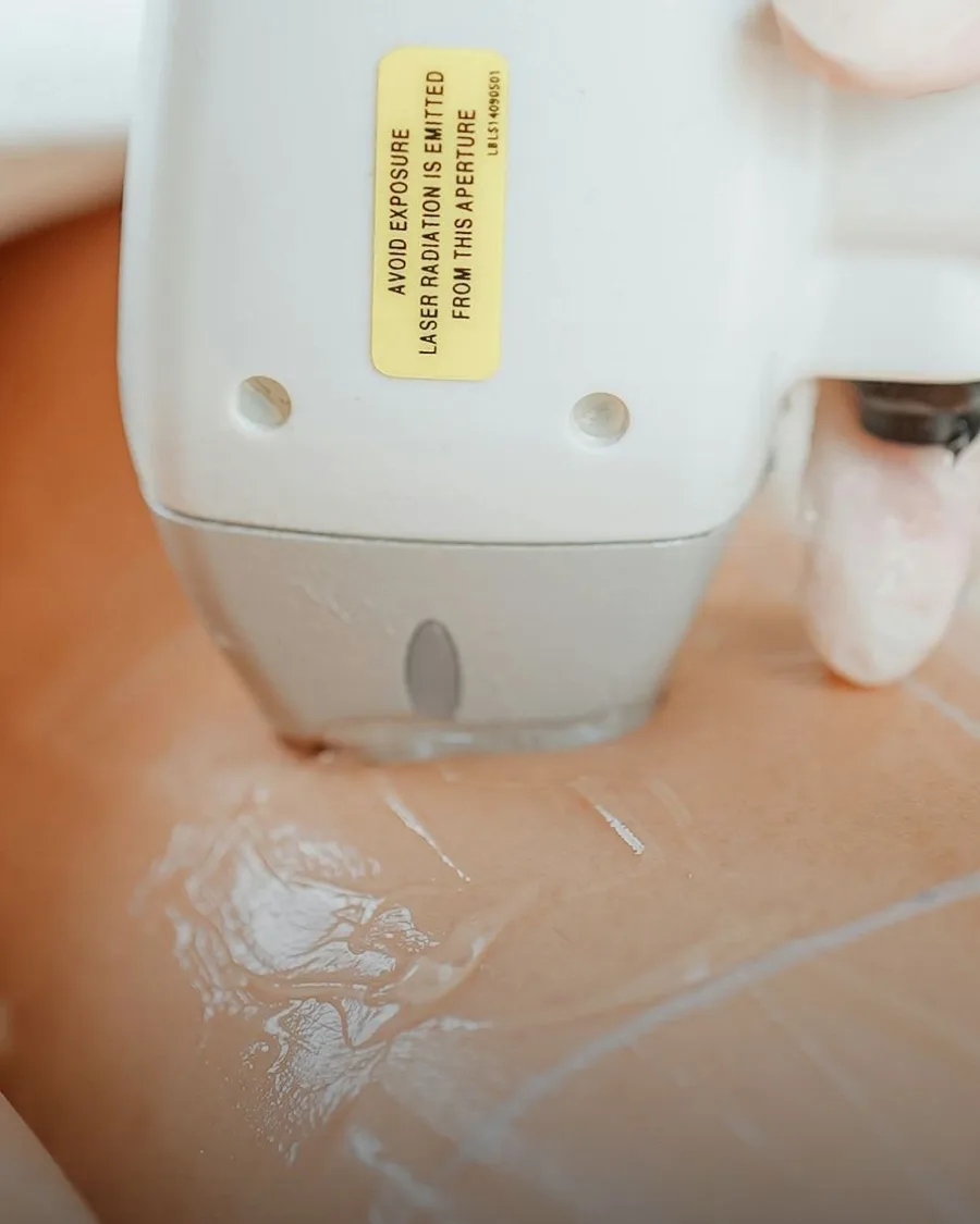 Laser Hair Removal at Back to 30 Med Spa