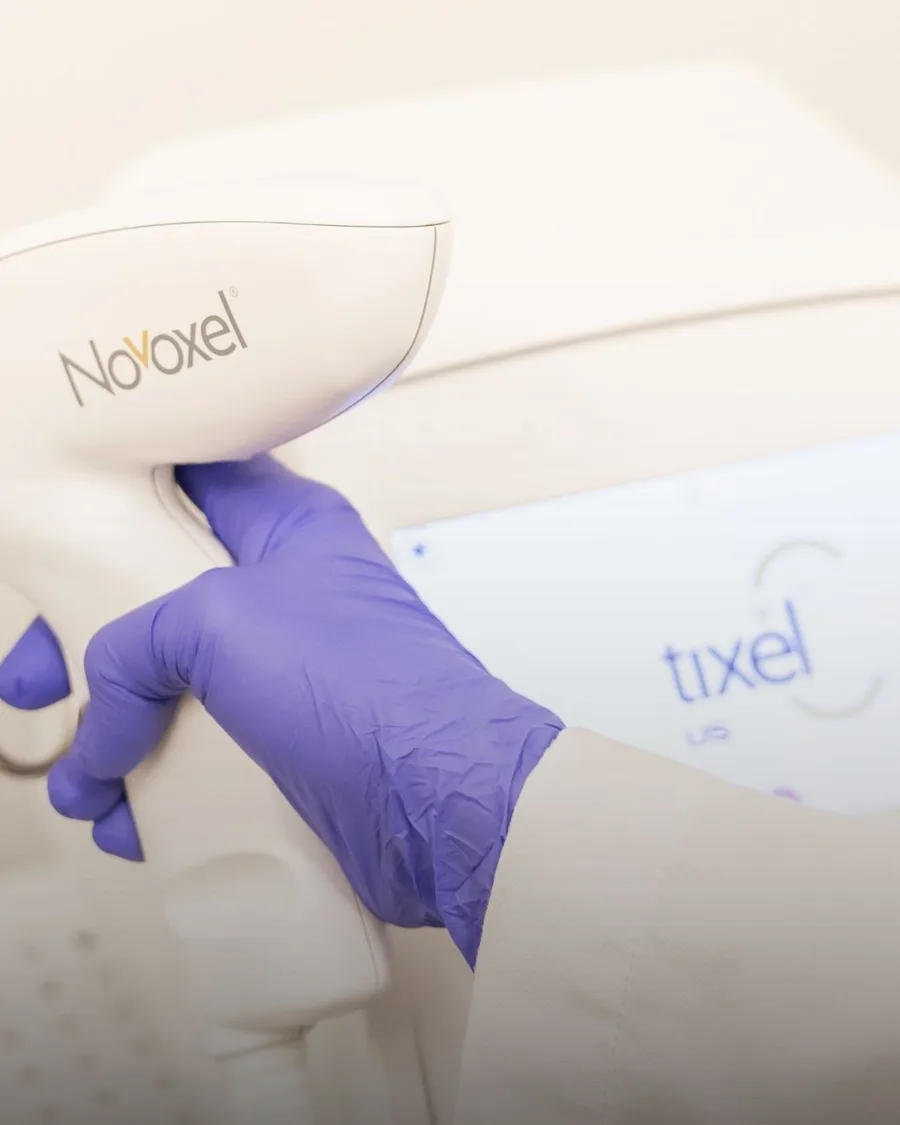 Tixel 2 Fractional Skin Rejuvenation at Back to 30 Med Spa